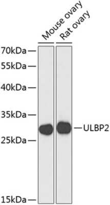 Western Blot: ULBP-2 AntibodyAzide and BSA Free [NBP2-94044]